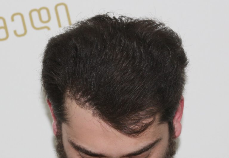 tmis-gadanergva-deamed