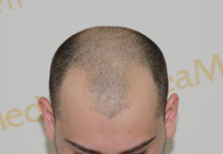 tmis-gadanergva-deamed