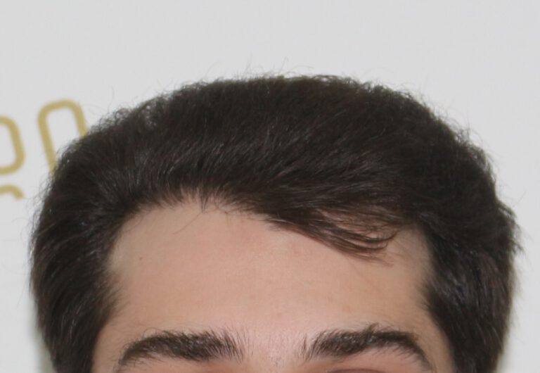 tmis-gadanergva-deamed