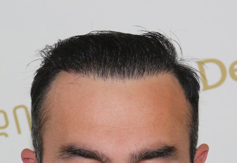 tmis-gadanergva-deamed