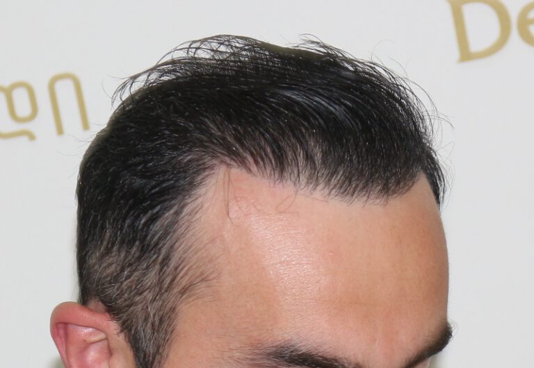 tmis-gadanergva-deamed