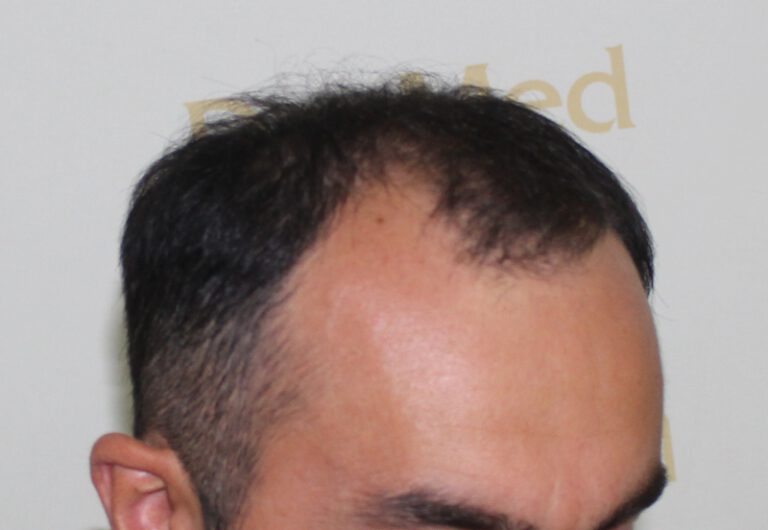 tmis-gadanergva-deamed