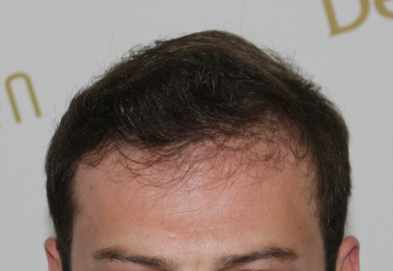 tmis-gadanergva-deamed