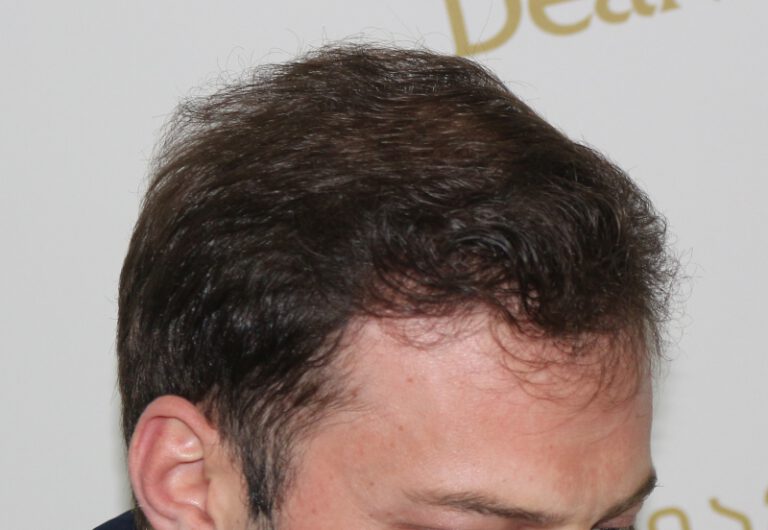 tmis-gadanergva-deamed