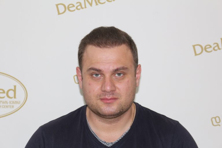 Deamed - hair transplantation results / თმის გადანერგვის შედეგები