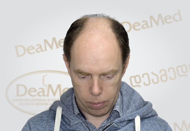 Deamed tmis gadanerg