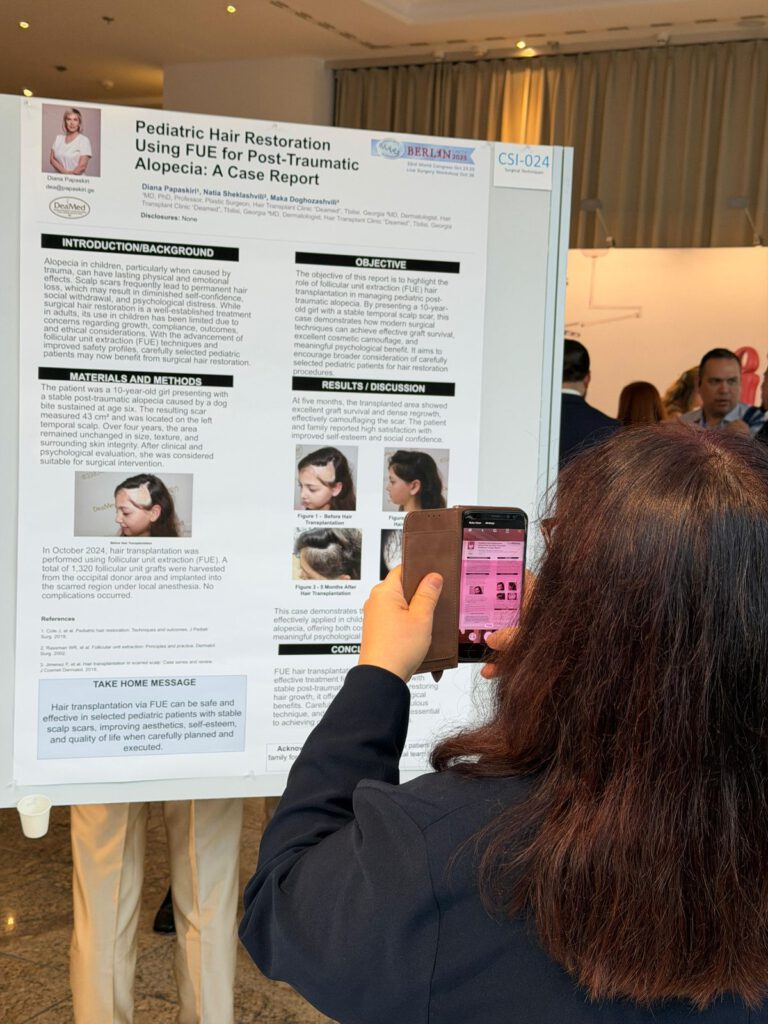 Deamed ISHRS 33 Congress