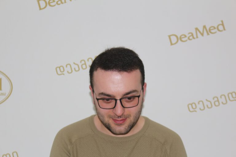 tmis-gadanergva-shedegebi