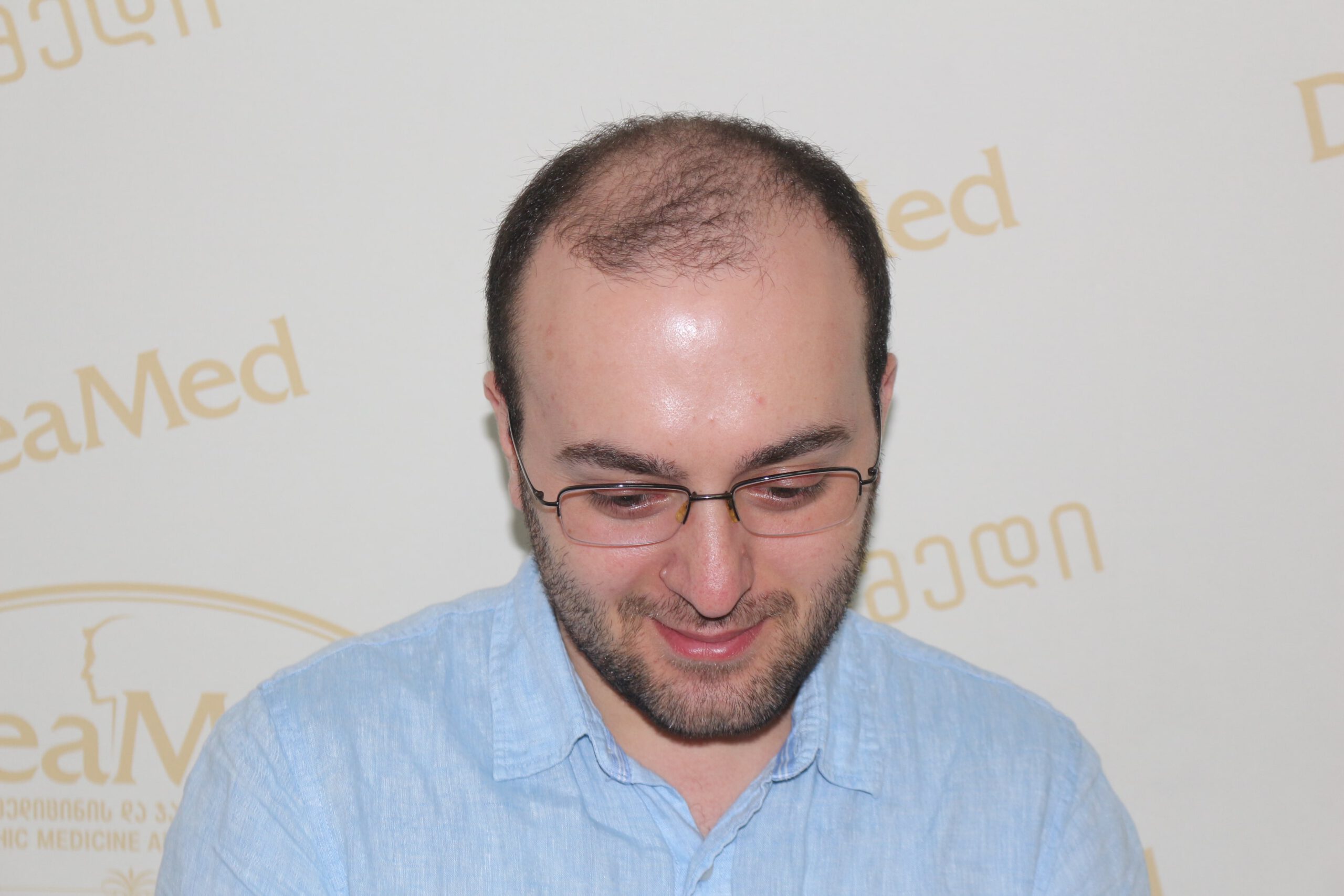 tmis-gadanergva-shedegebi