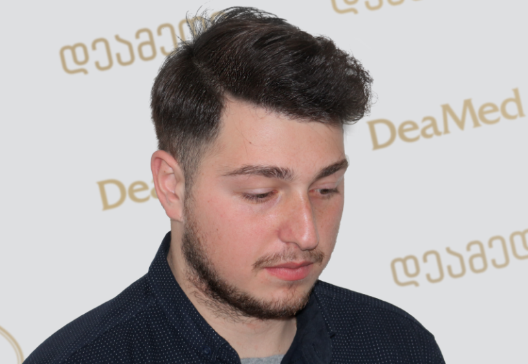 tmis gadanergva shedegebi