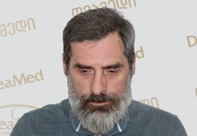 Deamed tmis gadanergva shedegebi