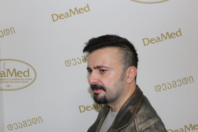 Deamed - hair transplantation results / თმის გადანერგვის შედეგები