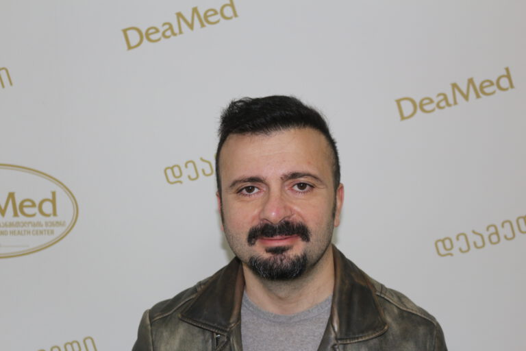 Deamed - hair transplantation results / თმის გადანერგვის შედეგები